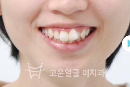 치료후기 이미지